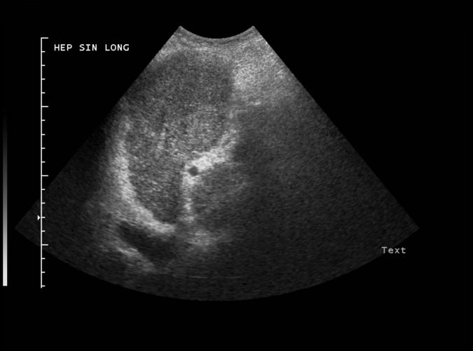 2h av  Catherine Olsson, sonograf